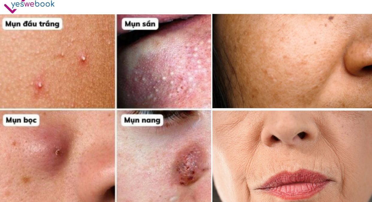 Should You Go to a Spa for Skincare? 3 Warning Signs