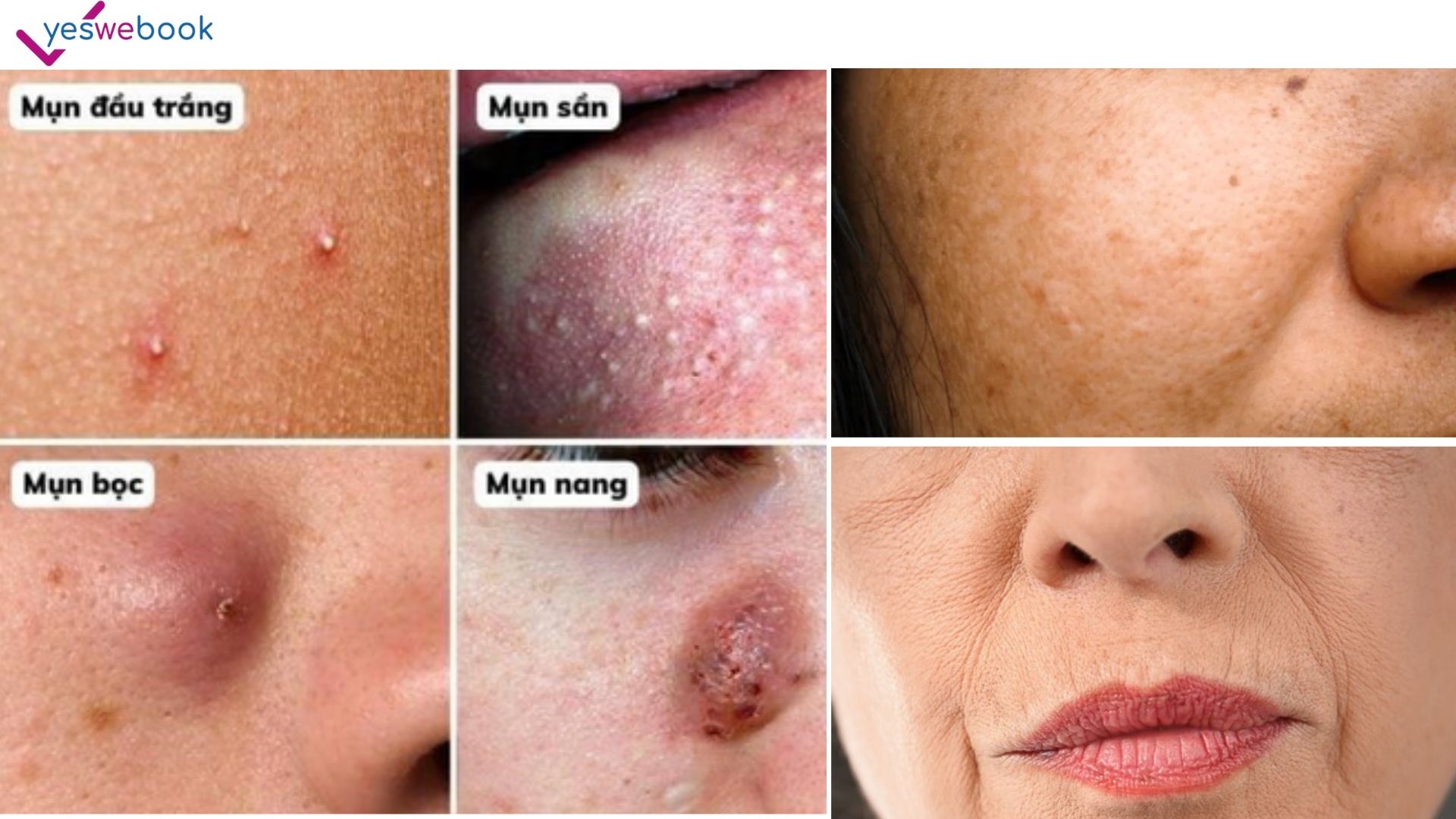 3 dấu hiệu báo động đỏ làn da