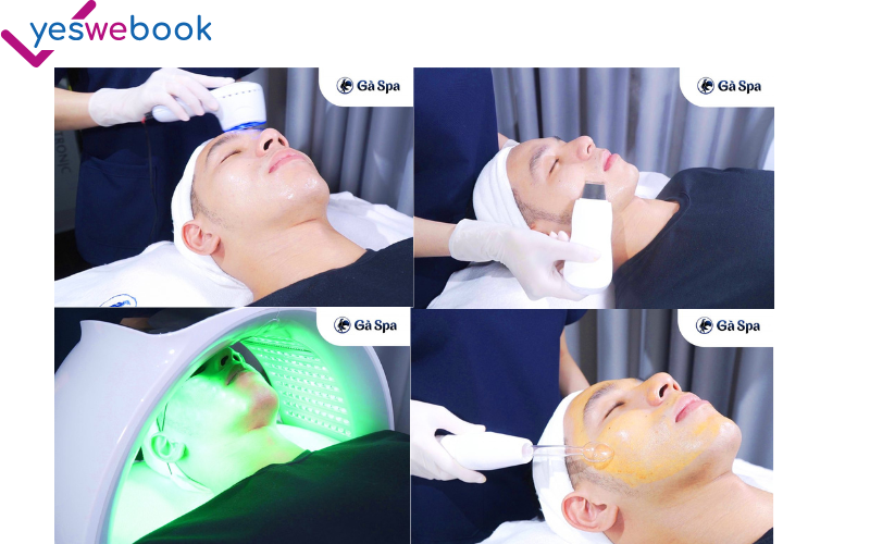 Hình ảnh trị mụn thực tế 5in 1 tại thẩm mỹ viện Gà Spa