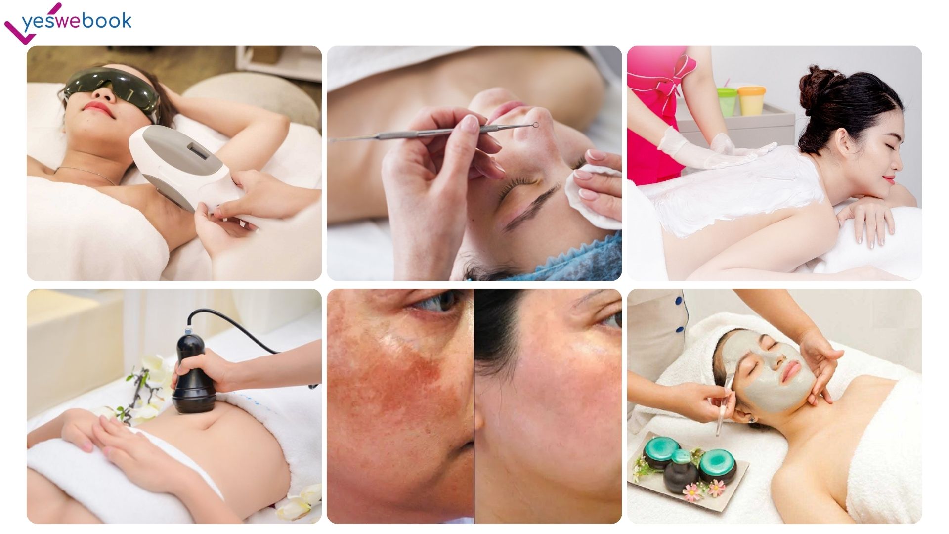 Giá dịch vụ spa tại sài gòn
