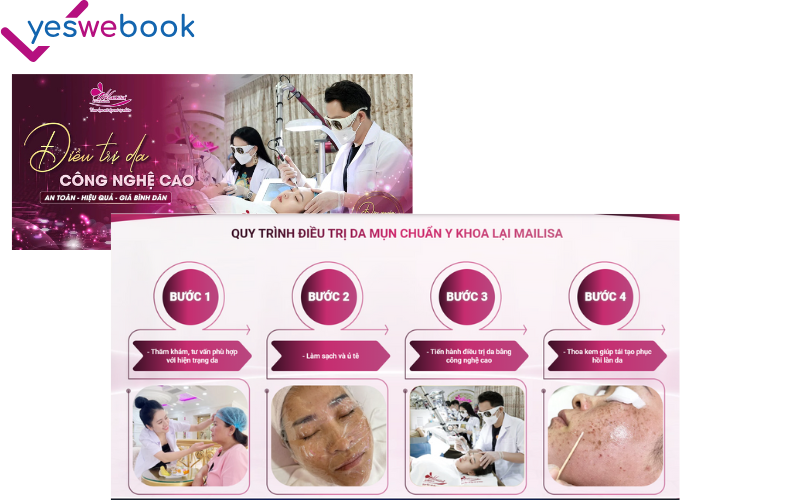 Quy trình 4 bước điều trình mụn tại thẩm mỹ viện malisa