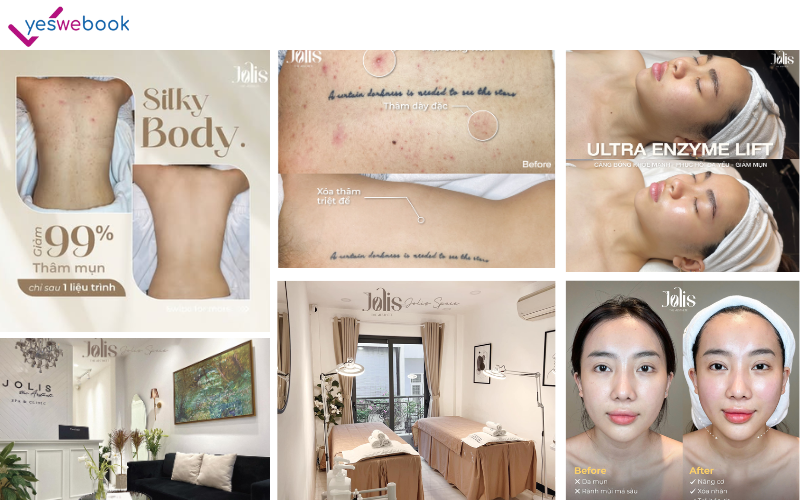 spa hàn quốc Jolis The Aesthete - Spa & Clinic