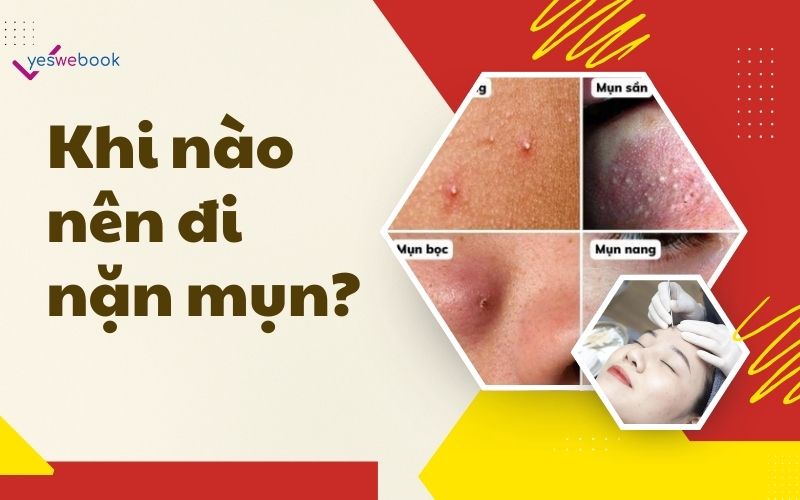 Khi nào nên đi nặn mụn