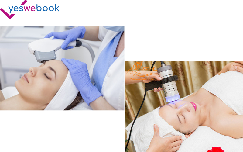 Làm trắng da bằng công nghệ ánh sáng IPL