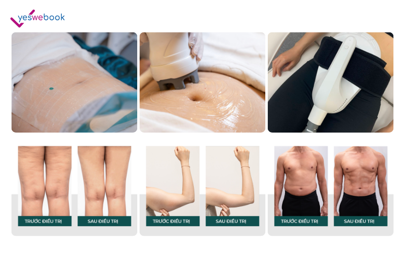 VITA Clinic - Spa giảm béo 